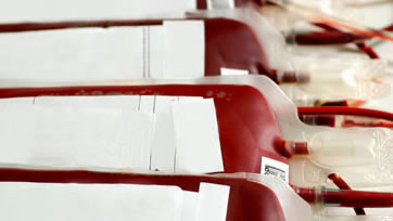 Riscos e benefícios da transfusão sanguínea
